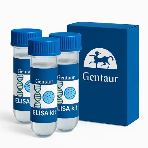 [80219] Urinary (NAG) Assay Kit - 100 Tests